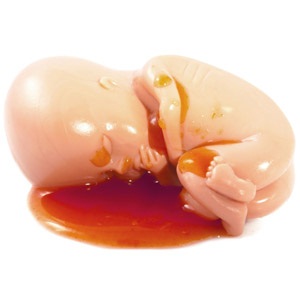 Foetus in blood from Shutterstock