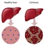 Liver cirrhosis cured in rats