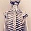 5 interesting facts about osteoporosis