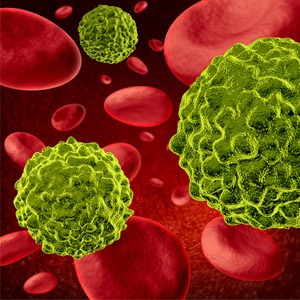 Cancer disease cells.