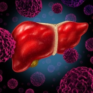 Illustration of liver disease
