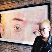 MY STORY| Living with albinism inspired me to create beautiful art