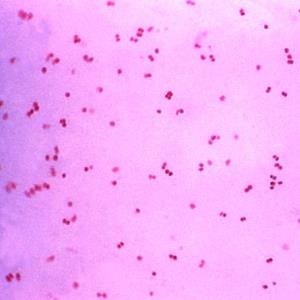 Neisseria gonorrhoeae 