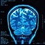 Brain scan yields clues to future stroke risk