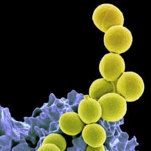 Resistant bacteria – Google free image