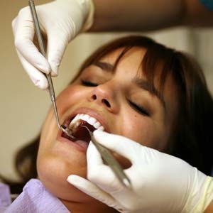 Woman with dental caries