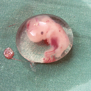A human embryo 8 weeks after fertilisation, "Human Embryo" by Dr. Vilas Gayakwad - Own work. Licensed under CC BY-SA 3.0 via Wikimedia Commons.