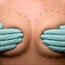 What is breast reconstruction?