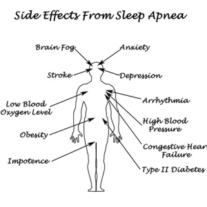 Sleep apnoea from Shutterstock