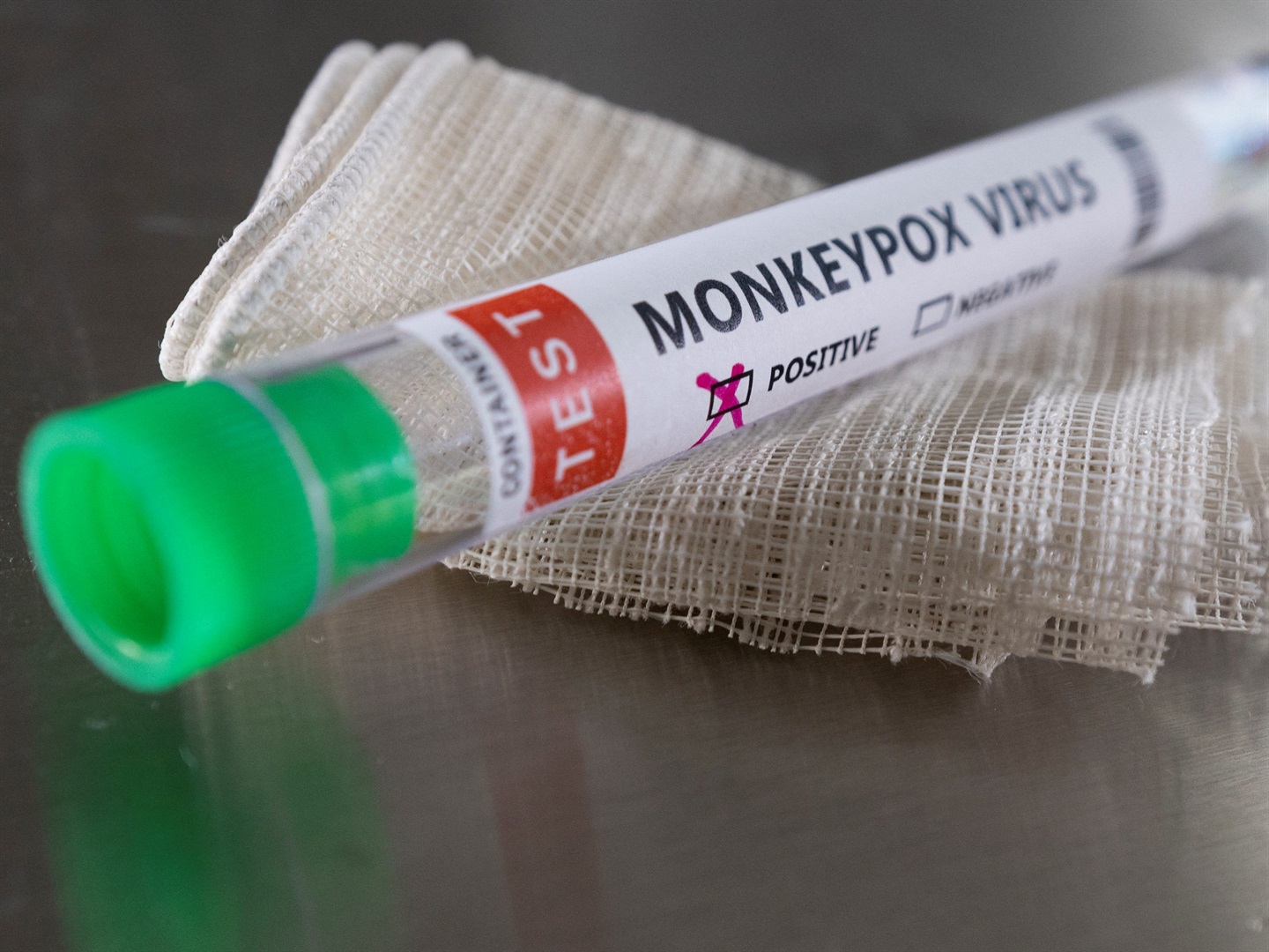 monkeypox virus.