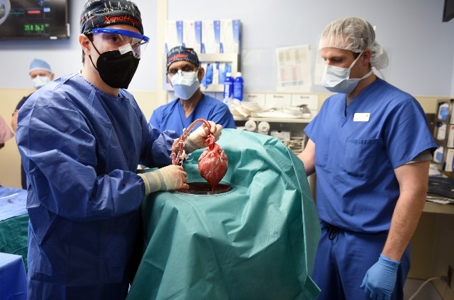 David's doctors with the pig's heart before perfor