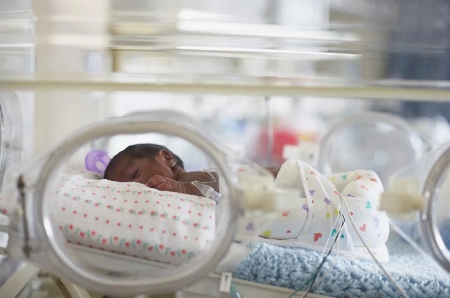 What to expect if you deliver your baby preterm.