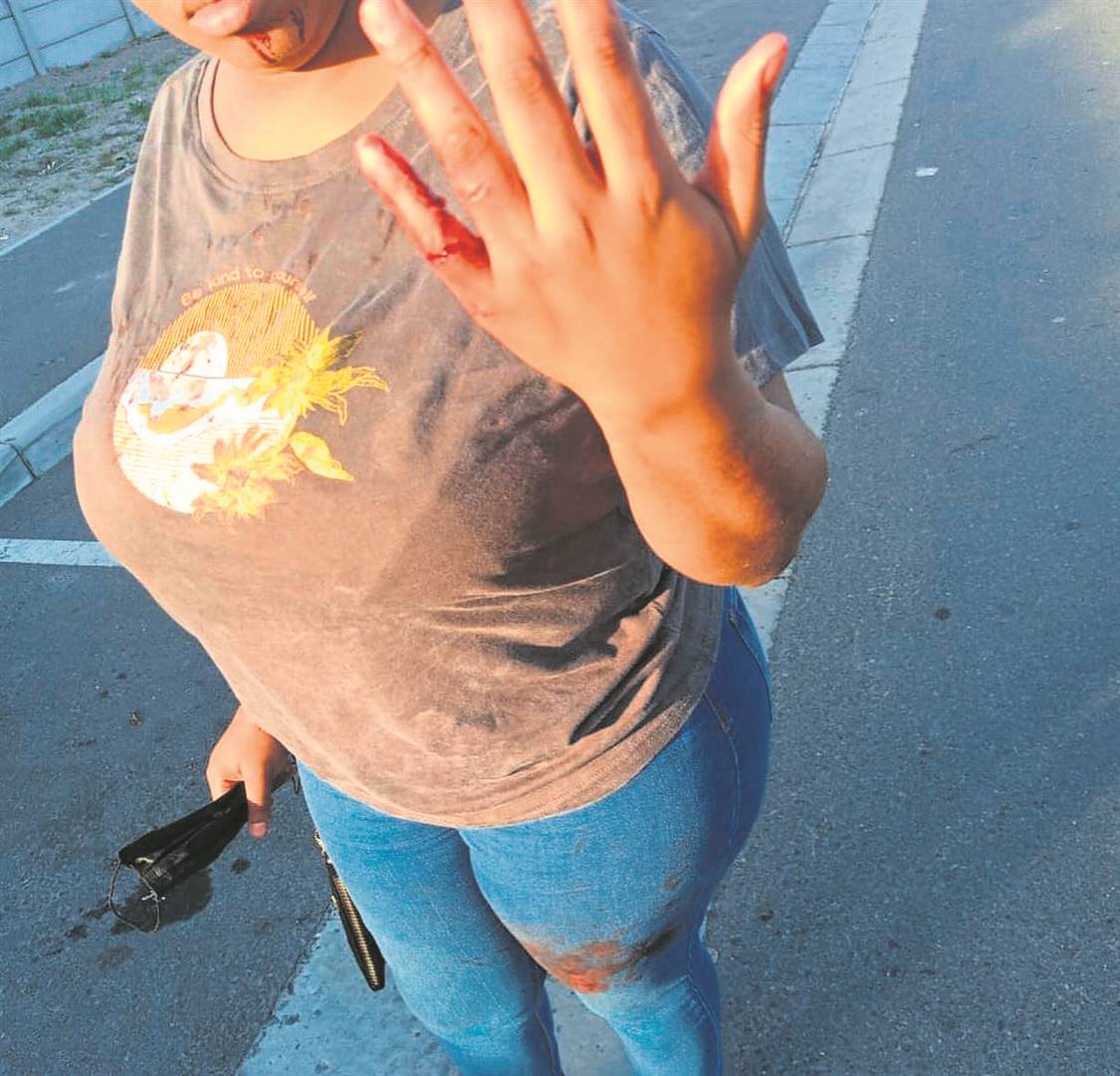 A female student from the University of the Western Cape was injured during a taxi robbery last month. 