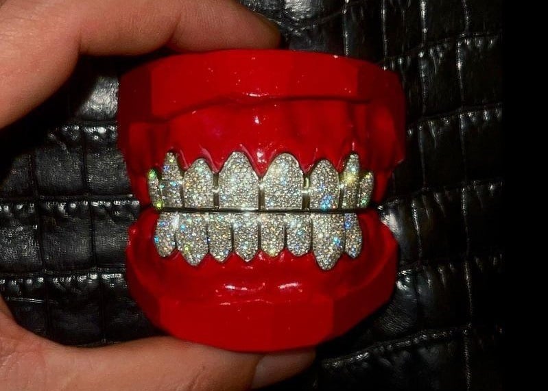 A set of bespoke 18kt white gold grillz replete with diamonds, worth R250 000. 