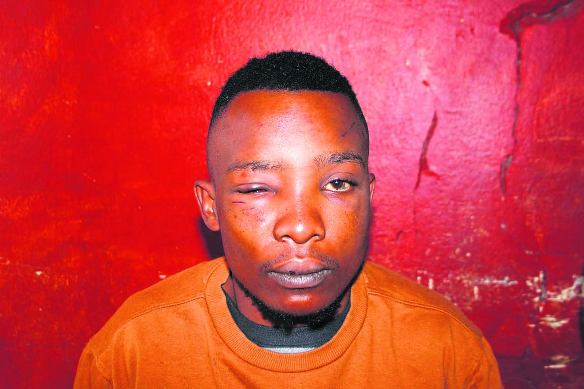 Nkululeko Mapapu claims that he was assaulted by his boss for not making enough money.       Photo by   Phineas Khoza