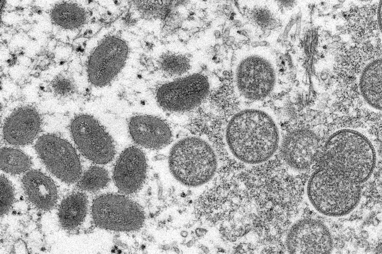 Só lyk die ovaalvormige aappokke-virus onder die mikroskoop. Foto: AP