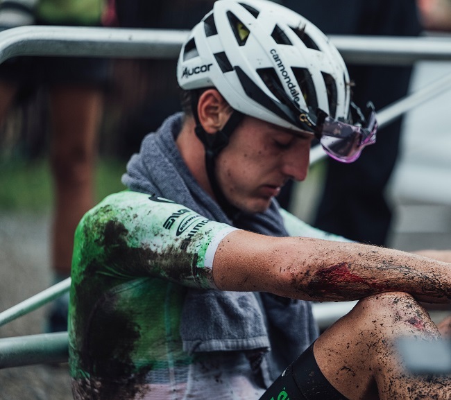 Alan Hatherly’s crash damage is visible on his bloodied forearm, after the Canadian UCI World Cup race. (Bartek Wolinski/Red Bull Content Pool)