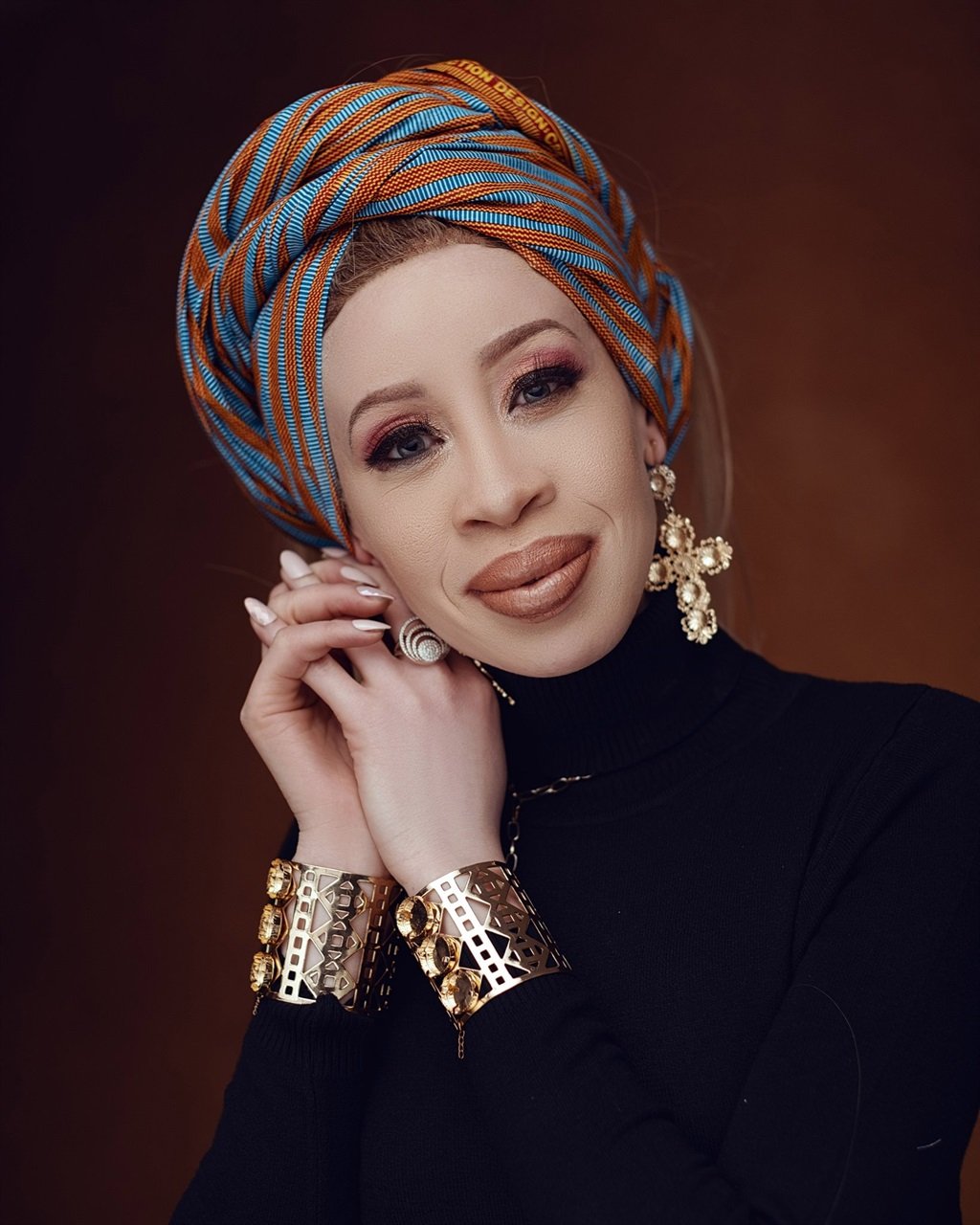Refilwe Modiselle will not do any interviews for the International Albinism Awareness Day.