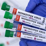 Monkeypox: Our top 10 questions answered