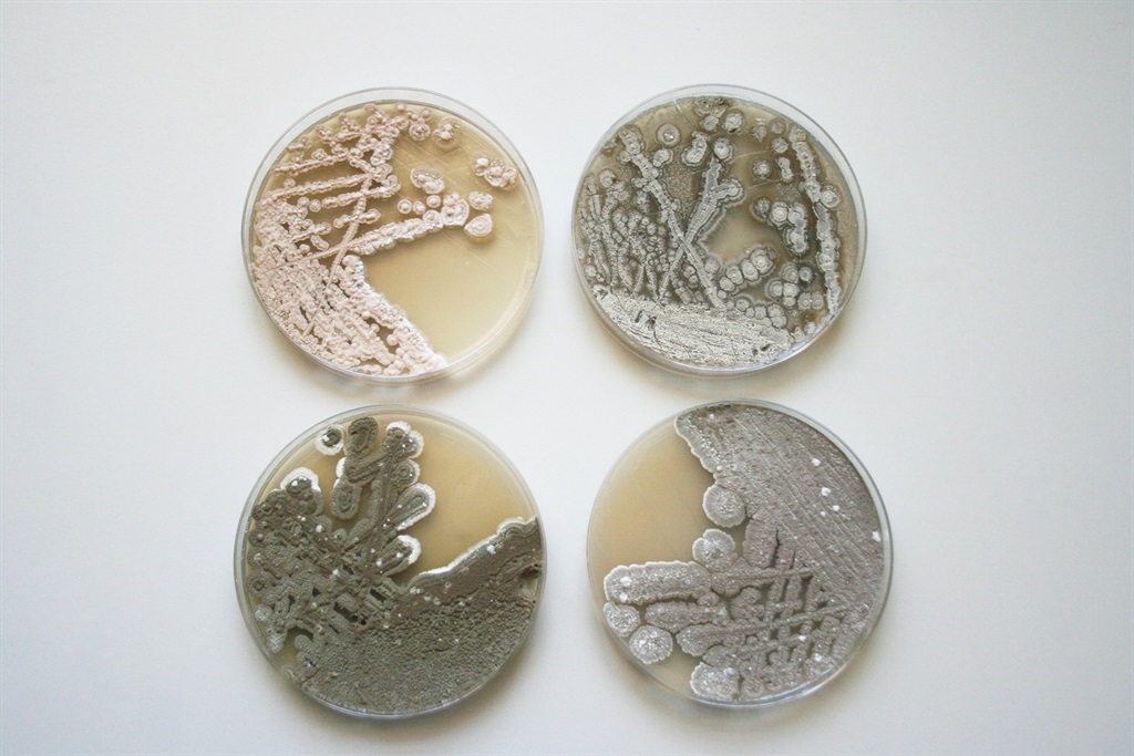 Suiwer kulture van vier Streptomyces-spesies wat in grond gevind word. FOTO: WILHELM BOTHA