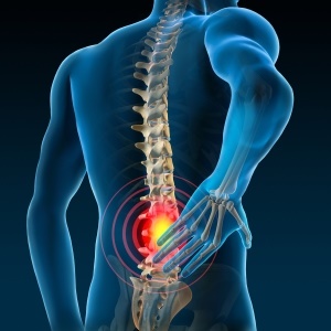 Back pain – iStock