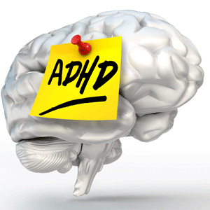 Yellow ADHD note on a brain