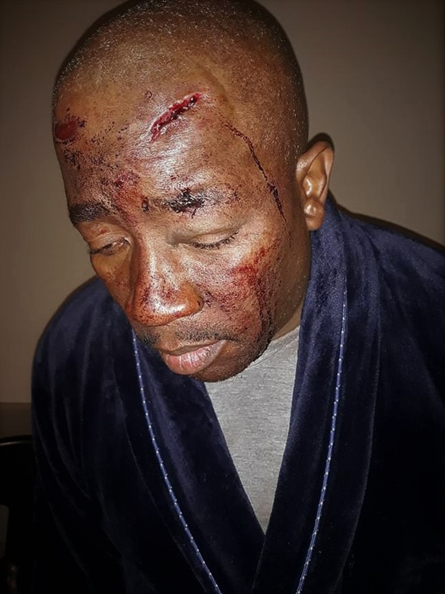 The man who gruesomely attacked Hartley Sandy Ngoato has been handed a three-year prison sentence for the racially motivated assault. Photo: Archive