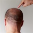 Natural ways to stop hair loss