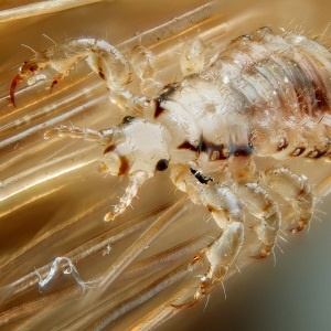 Head louse - Google Free Images