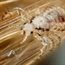 US toddler dies after lice treatment goes wrong