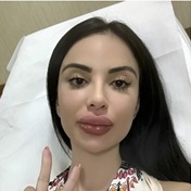 SEE THE PICS: Model regrets ‘keeping up’ after forking out more than R10 million to look like Kim Kardashian