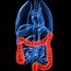 Six ways to reduce your risk of colon cancer