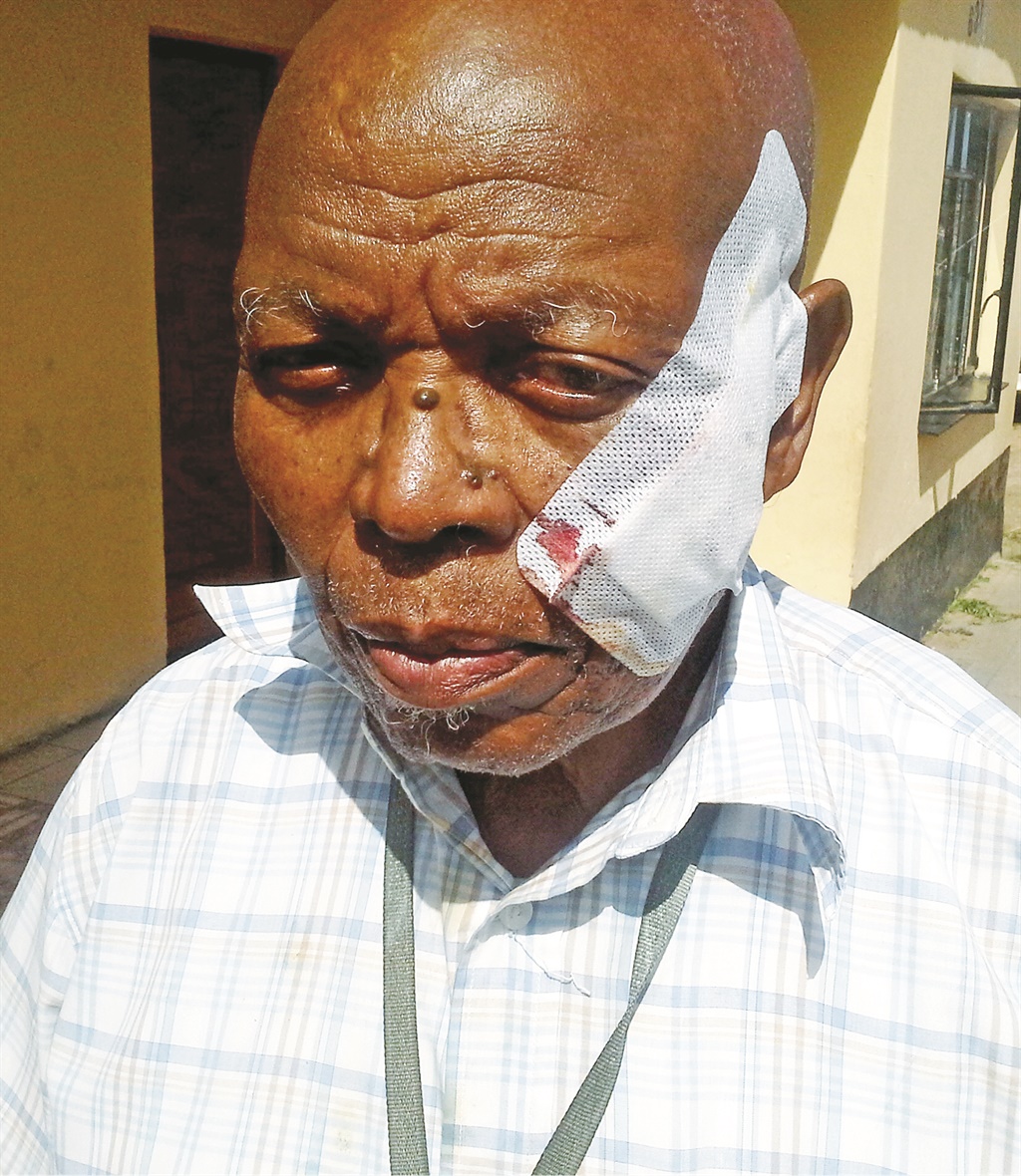 Madala Sydwel Nontanda is nursing his wounds after the alleged assault.  Photo by Unathi Mshumpela 