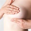 Breast cancer patients choose to have healthy breast removed