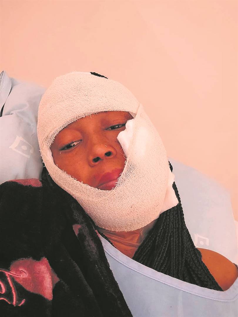 Charlotte Motlhagodi had to undergo surgery after she was stabbed in the face. 