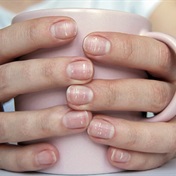 White spots on your nails? Expert explains what they mean and how to get rid of them