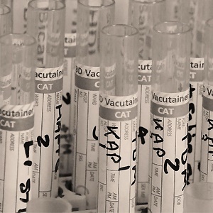 Vials used in clinical trials. Source: Pixabay.