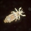 Should you be worried about head lice?