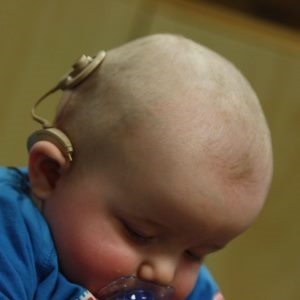 Baby with cochlear implant