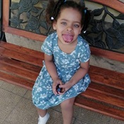 How surgery changed the life of this little girl from Oudtshoorn whose enlarged tongue couldn't fit in her mouth
