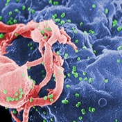 While Covid-19 grabs global headlines and funding, HIV infections rise