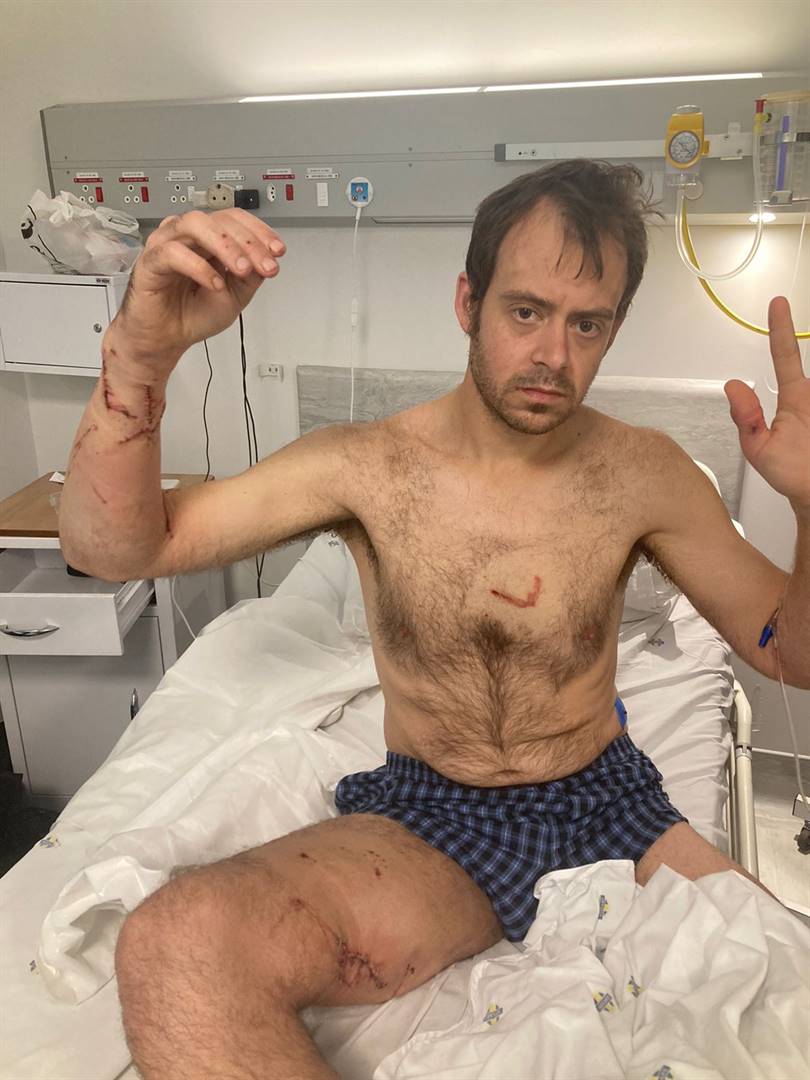 René Memmel (38) is Vrydagoggend deur twee pitbulls aangeval. Hy sterk steeds in die hospitaal aan nadat hy ’n drie uur lange operasie ondergaan het.  Foto: Verskaf