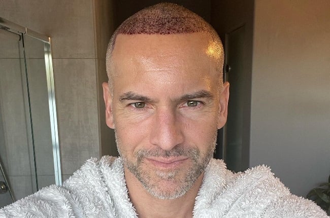 Janez Vermeiren is loving his hair transplant – here's more about the  increasingly popular treatment for men | You