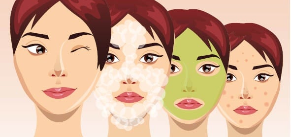 Myths About Acne | Life