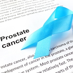 Aspirin has little effect on prostate cancer. 