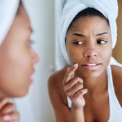 Microneedling vs chemical peels for acne scars: which is more effective?