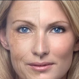 Wrinkles, before and after – Google Free Image