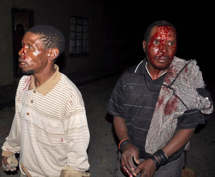Nthebe Nthebe and his brother Morena were saved by the cops after being attacked by angry people at their house on Tuesday night in Phase 6, Mangaung, Bloemfontein. Photo by Kabelo Tlhabanelo
