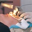 FDA approves eye implant for better focusing