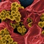 Some steroids raise risk for serious staph infections